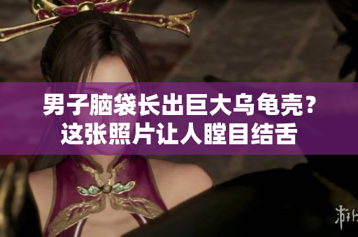 男子腦袋長(zhǎng)出巨大烏龜殼？這張照片讓人瞠目結(jié)舌